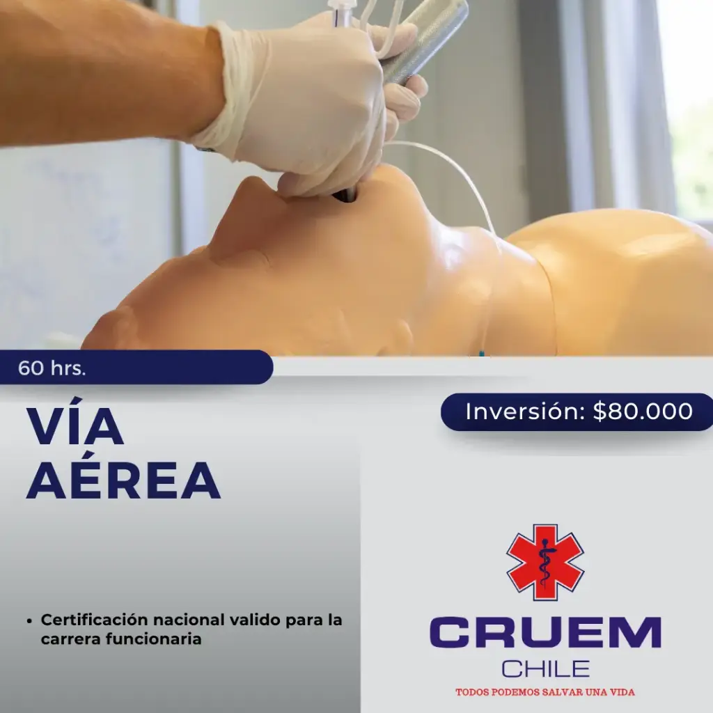 Vía Aérea